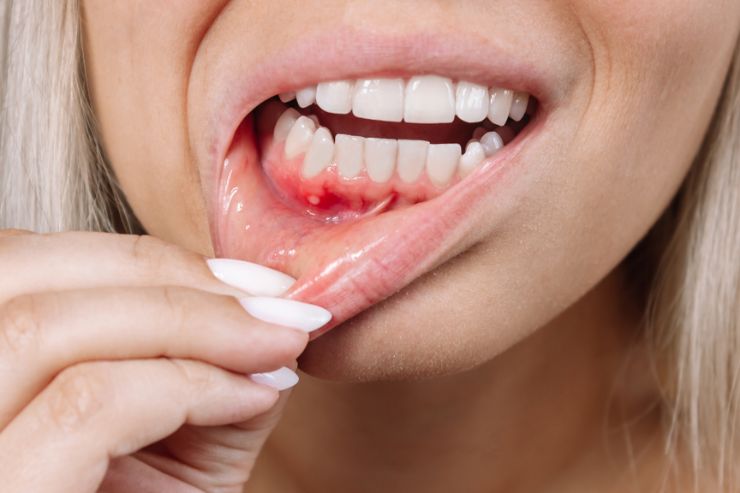 Periodontics