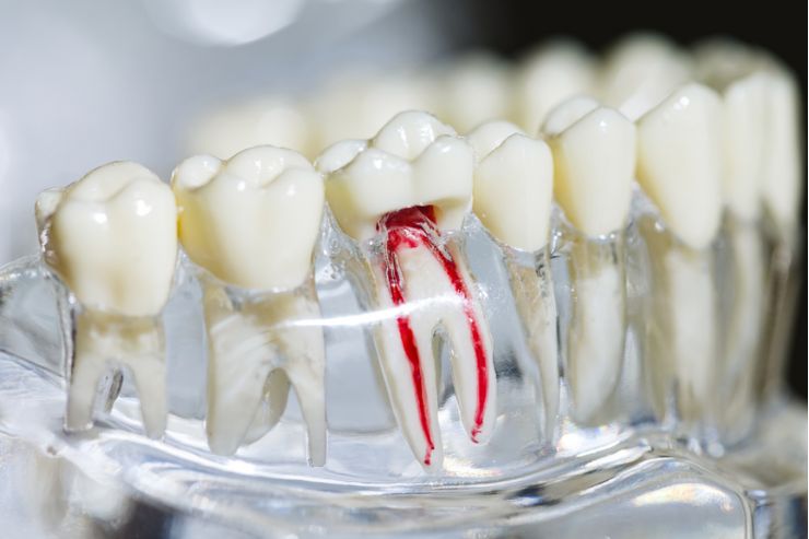 Endodontics